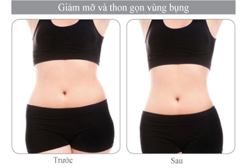 vinhy-hipro-giam-mo-va-thon-gon-vung-bung