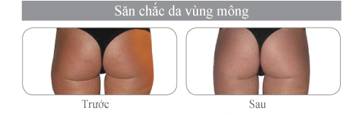 vinhy-hipro-san-chac-da-vung-mong