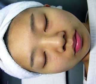 vinhy-carbon-gel-cach-su-dung-buoc-1