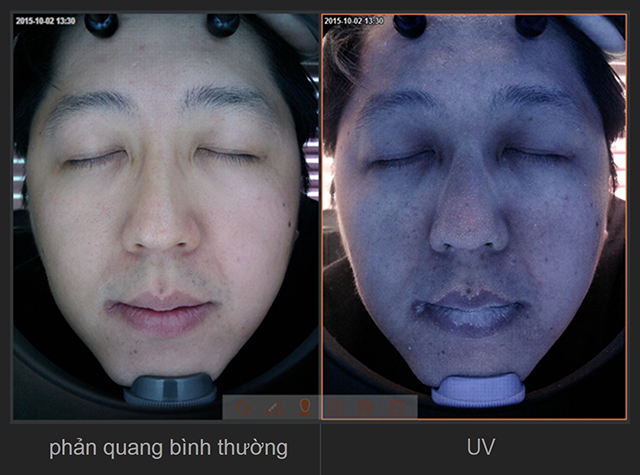a-one-simple-he-thong-tu-dong-nhan-khuon-mat