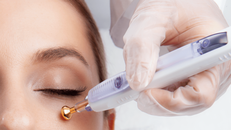dau-dieu-tri-ma-vang-cua-may-laser-xoa-nhan-nang-co-cua-my-2-min-1