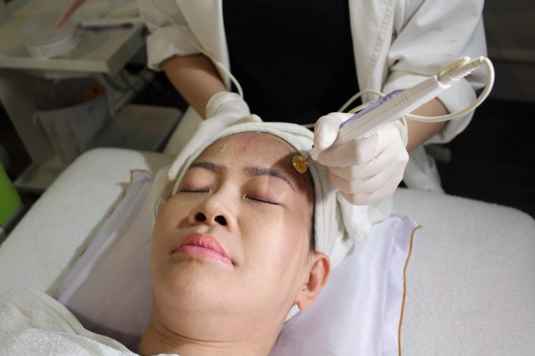 may-laser-xoa-nhan-nang-co-hieu-qua-tu-pelleve-dieu-tri-khong-dau-3-e1528863559183-1