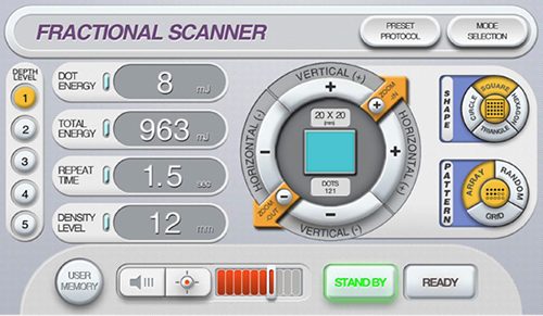 innoscan-fractionnal-scanner