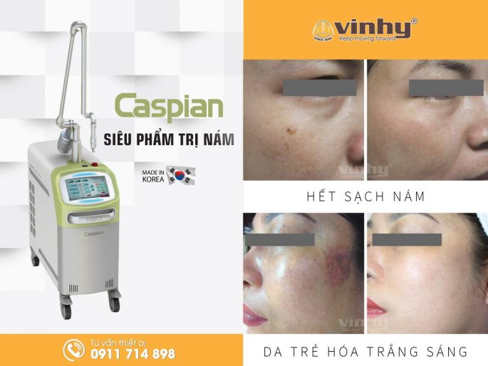 may-dieu-tri-xoa-nam-cho-spa-3