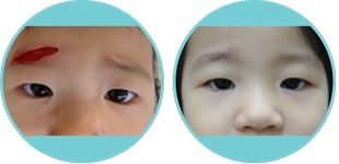 devoir-lanh-thuong