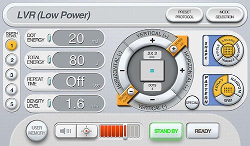 Hướng dẫn cơ bản về CÔNG NGHỆ CO2 FRACTIONAL